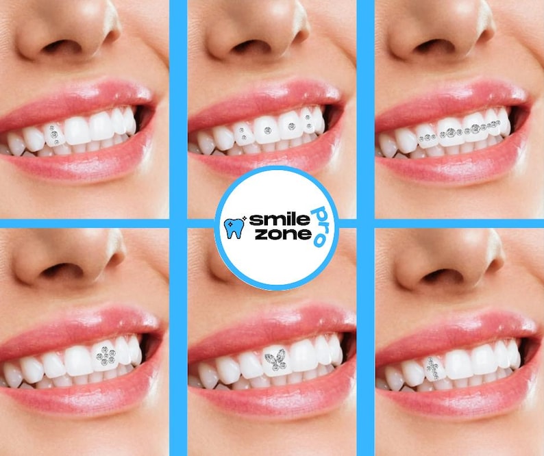 May include: A collage of close-up images showcasing various dental jewelry designs on bright white teeth. The designs include individual gems, clusters, and a butterfly shape. The "Smile Zone Pro" logo is in the center.