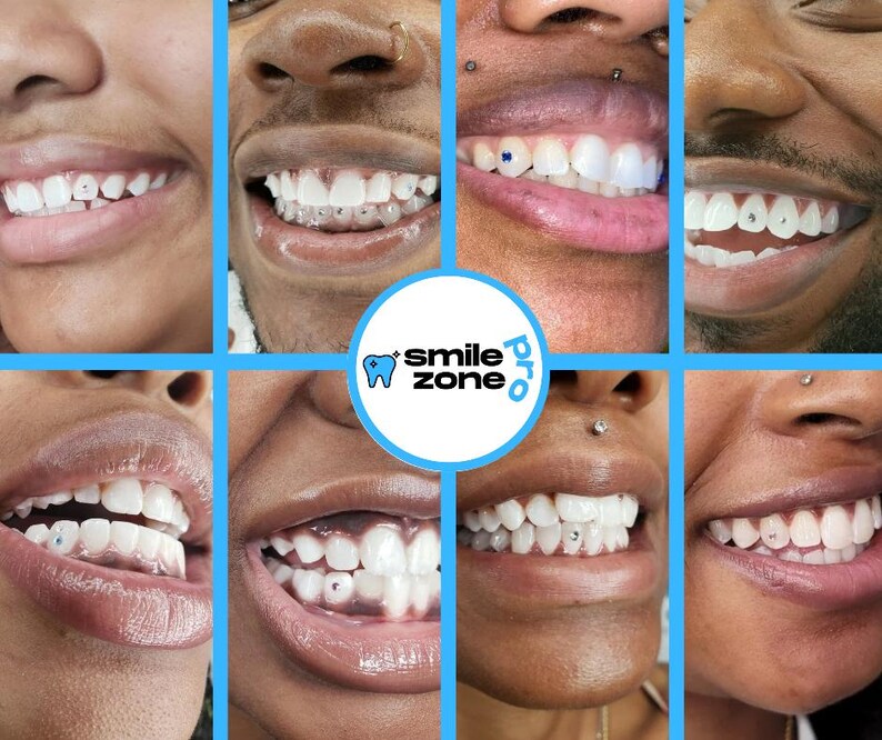 May include: A collage of close-up shots of various people's smiles, showcasing teeth with decorative gems. The images are arranged in a grid, with a central logo that reads "smile zone pro."