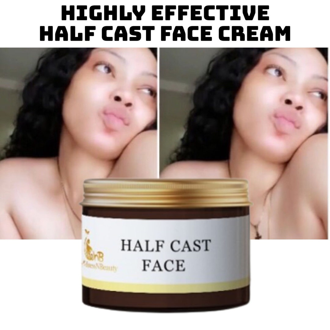 Half Cast Skin Whitening Face Cream 10X Etsy