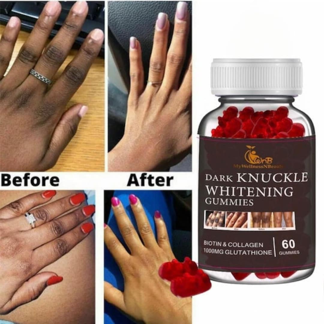 Knuckle Whitening dark Knuckles Gummies. Collagen.knuckle Etsy