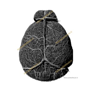 Blood Vessels of the Brain