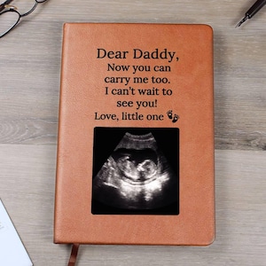 Personalized Ultrasound Leather Jounal, Custom Ultrasound Notebook, Bump Journal, Dad Birthday Gift from Bump, Dad to Be Gift for Husband