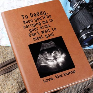 Custom Ultrasound Leather Jounal, Personalized Ultrasound Journal, Bump Notebook, Dad Birthday Gift from Bump, Dad to Be Gift for Husband