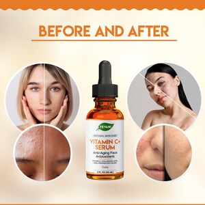 May include: An amber glass bottle of Yevani Vitamin C+ Serum with a black dropper. The label reads "Anti-Aging Face Antioxidant." The image shows before and after photos of skin, with the text "BEFORE AND AFTER" at the top.