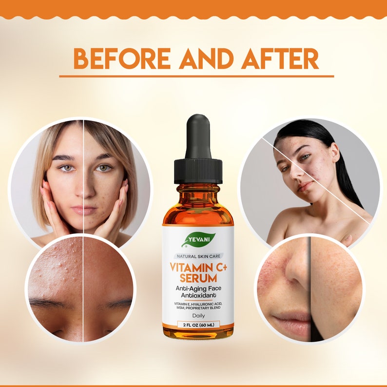 May include: An amber glass bottle of Yevani Vitamin C+ Serum with a black dropper. The label reads "Anti-Aging Face Antioxidant." The image shows before and after photos of skin, with the text "BEFORE AND AFTER" at the top.