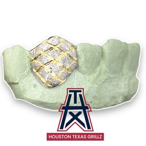 Custom 1 Diamond Dust & Diamond Cut Tooth
