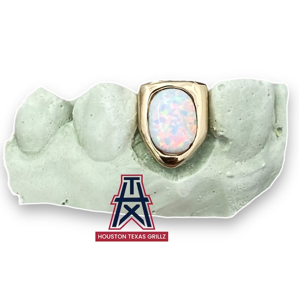 Custom 1 Single Tooth Open Face Opal Stone Grillz