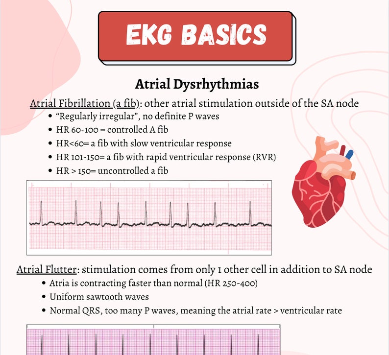 Ekg basics etsy