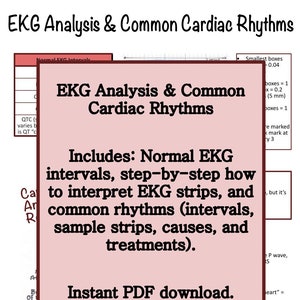 EKG Analysis & Cardiac Rhythm Study Guide