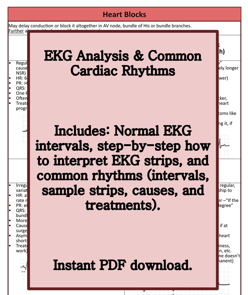 EKG Analysis & Cardiac Rhythm Study Guide - Etsy