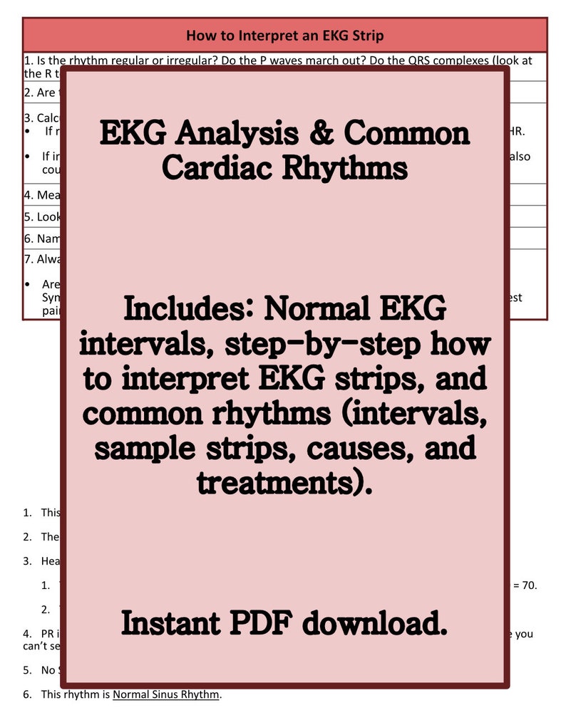 EKG Analysis & Cardiac Rhythm Study Guide - Etsy