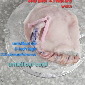 Pu&ograve; includere: Una placca addominale rosa pallido di 11,43 cm di altezza e larghezza, con un cordone ombelicale realistico di 15,24 cm di altezza e 6,35 cm di circonferenza, fissato da una pinza in plastica rosa chiaro, su una base circolare argentata.
