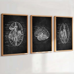 May include: Three framed anatomical brain diagrams. Each diagram features a detailed, grayscale illustration of the brain's structure against a black background. The frames are a light brown colour, and the diagrams are labelled with anatomical terms.