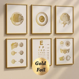 6 Gold Eye Anatomy Art Medical Art Eye Diagnoctic Poster Optometry Art Ophthalmologist Gift Eye Clinic Decor Optician Office Gift