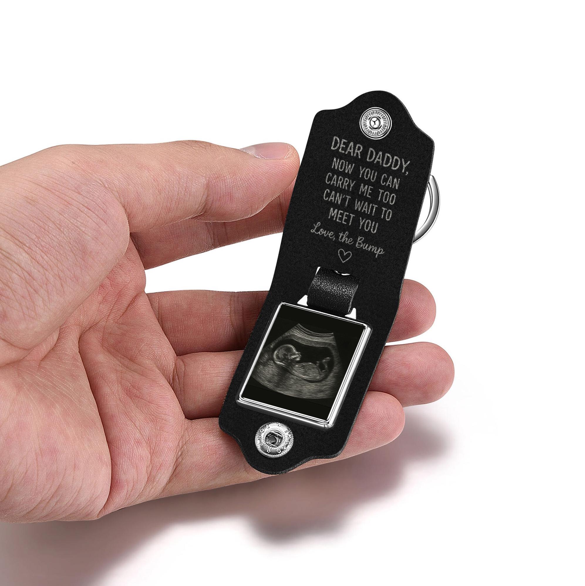 Custom Ultrasound Photo Leather Keychain: Daddy Gift from Bump