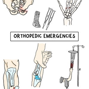 Orthopedic Injuries Emergency Nursing Notes, Notes for the Emergency Nurse, New-Grad RN Notes, CEN Review Study Guide