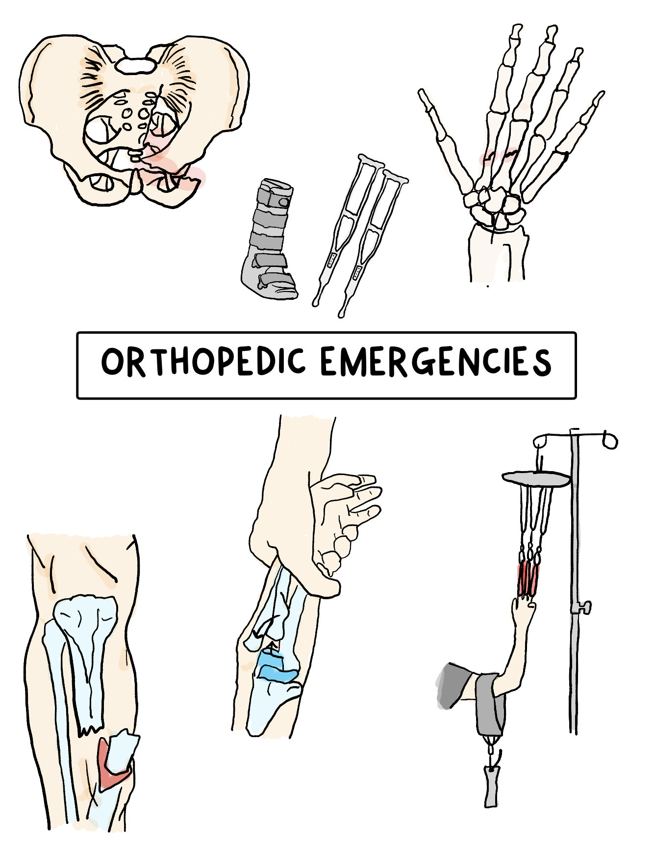 Orthopedic Injuries Emergency Nursing Notes, Notes for the Emergency ...