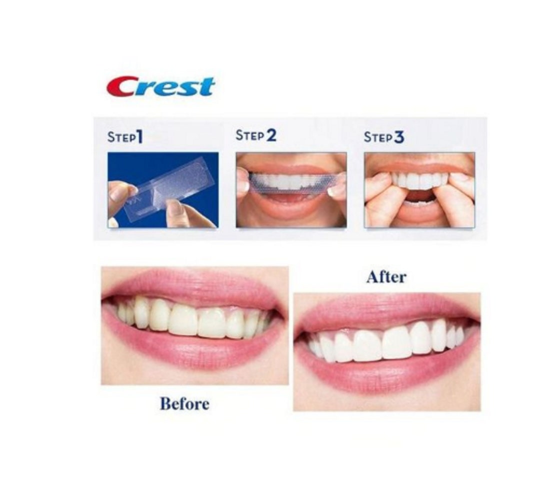 Crest Glamorous Crest 3D Whitestrips GLAMOROUS WHITE Crest Etsy