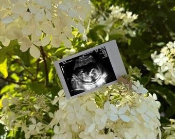 Editable Baby Announcement Template | Floral Ultrasound Reveal | Polaroid Style | Digital Download | Gender Neutral Pregnancy Reveal