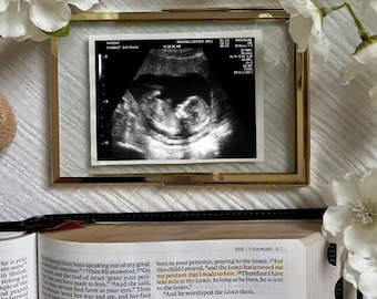 Religious Pregnancy Announcement Digital | Baby Announcement Template | Pregnancy Reveal for Social Media | Ultrasound | Digital Download