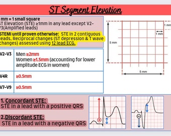 12 lead ECG colourful guide