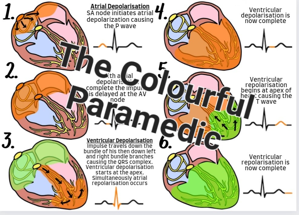 The Three Lead ECG Guide Part One - Etsy UK