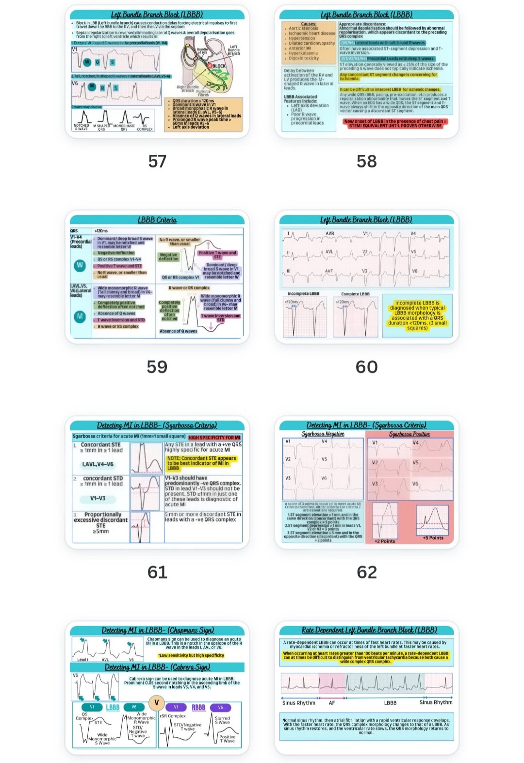 12 Lead ECG Colourful Guide - Etsy