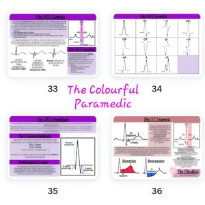 The Three Lead ECG Guide Part One - Etsy