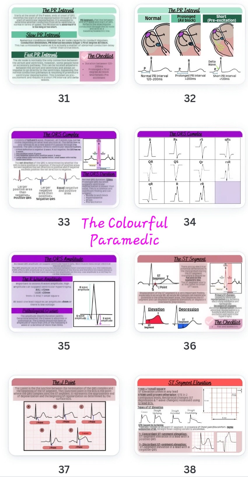 Ecg Guide The Three Lead ECG Guide Part One - Etsy