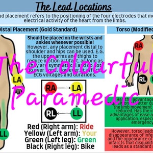 The Three Lead ECG Guide Part One
