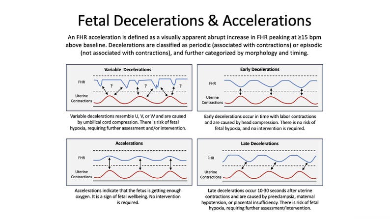 May include: A medical diagram titled "Fetal Decelerations & Accelerations" displays graphs illustrating fetal heart rate patterns. The image includes descriptions of variable, early, late decelerations, and accelerations, with explanations of their causes and implications.