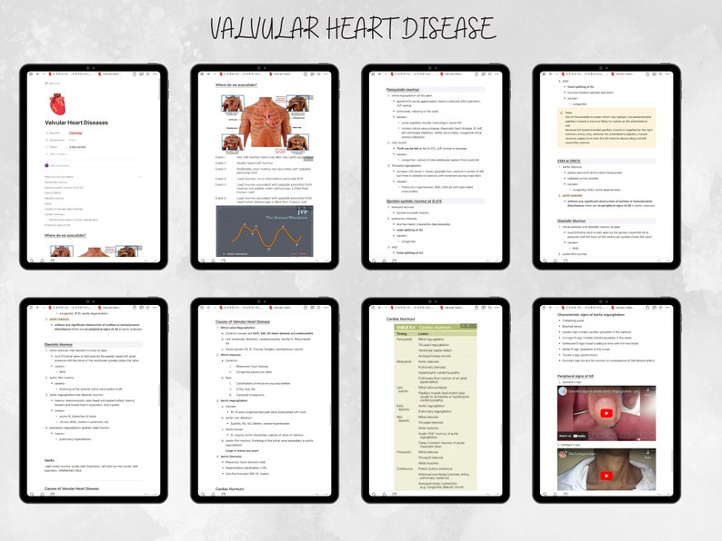 Notion Templates for Medical Students Medical Notes Digital Notes
