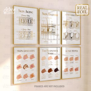 May include: Six framed educational posters with gold foil accents. The posters cover topics such as skin aging, skin anatomy, acne formation, skin diseases, the Fitzpatrick scale, and acne types. The text "FRAMES ARE NOT INCLUDED" is at the bottom.