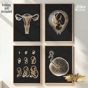 Pregnancy Anatomy Poster Set of 4 – Black and Gold Foil – Uterus, Placenta, Fetal Development – Gynecology & Maternity Decor