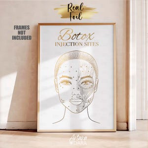 Real Gold Foil Botox Injection Sites Art Print, Cosmetic Injector Decor, Medical Aesthetician Gift