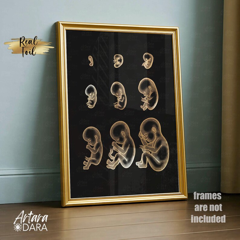 Gold Foil OBGYN Poster Set –uterus, Embryo Stages, Conception, Baby in ...