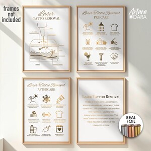 Eliminación de tatuajes con láser, Impresión con láminas metálicas, Cuidados posteriores a la eliminación de tatuajes, Decoración de habitaciones con láser, Decoración de salones de tatuajes, Arte para clínicas de belleza, Impresión para salones de belleza