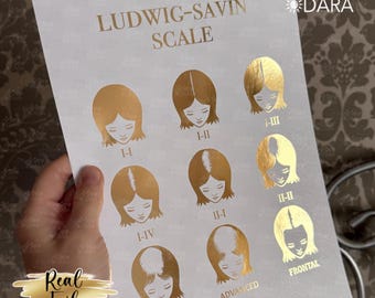 Poster Dermatologico - Scala Densità Perdita Capelli Maschile Savin - Strumento Medico - Foto 2