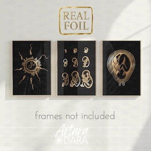 Fertilization and Embryo Development Poster Set – Black and Gold Foil – Gynecology & Obstetrics Wall Art