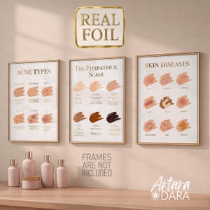 May include: Three framed educational posters with gold trim, labeled "Acne Types", "The Fitzpatrick Scale", and "Skin Diseases". Below, several pink cosmetic bottles and jars are arranged on a wooden surface. The text "Real Foil" is above the posters.