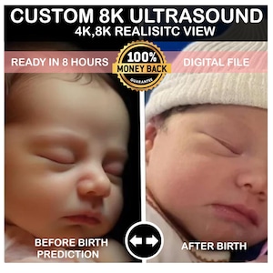 Ultrasound 8k baby image 3d 4d 5d 8d Real View Baby AI photo transformation Echography Scans first baby photo