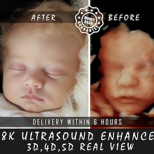 8K Enhanced Ultrasound: From Bumps to Realistic Faces | Precision 3D/4D/5D/HD Imaging | Perfect Baby Shower Surprise and Ultrasound Gift Ai