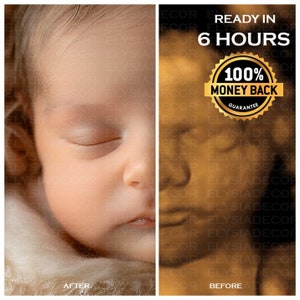 8K Enhanced Ultrasound: From Bumps to Realistic Faces | Precision 3D/4D/5D/HD Imaging | Perfect Baby Shower Surprise and Ultrasound Gift Ai