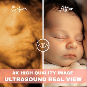 Ultrasound 8K Enhanced Ultrasound: From Bumps to Realistic Faces | Precision 3D/4D/5D/HD Imaging | Perfect and Ultrasound Gift