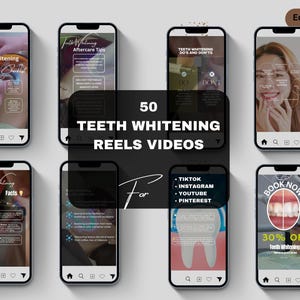 Plantillas de Instagram para videos de blanqueamiento dental / Blanqueamiento dental con LED / Publicaciones sobre blanqueamiento dental / Publicaciones en redes sociales para videos de blanqueamiento dental