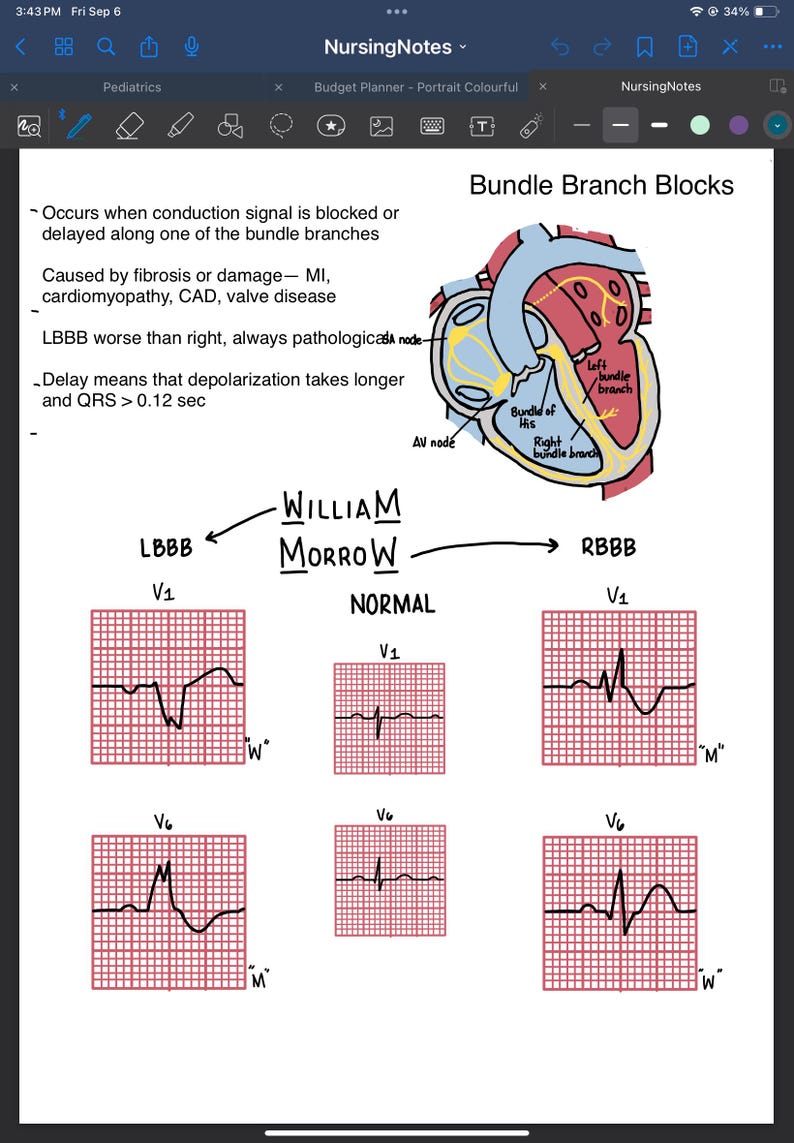 Cardiology Notes - Etsy