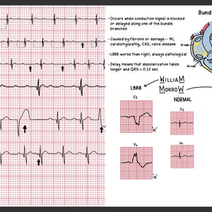 Nurse Basics for the ED