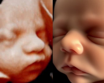 Ultrasaund 8k baby image 3d 4d 5d 8d Real View Baby AI photo transformation Echography Scans first baby photo