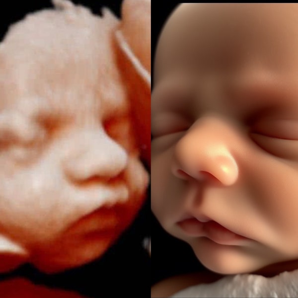 Ultrasaund 8k bébé image 3d 4d 5d 8d Real View Baby AI photo transformation Échographie Scanne la première photo de bébé