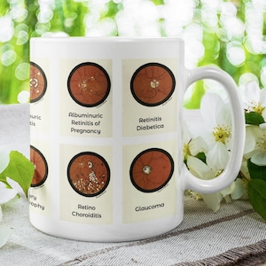 Può includere: Tazza in ceramica bianca con illustrazioni di condizioni oculari, tra cui Retinite Albuminurica della Gravidanza, Retinite Diabetica, Retinocoroidite e Glaucoma. La tazza è circondata da fiori bianchi e fogliame verde.